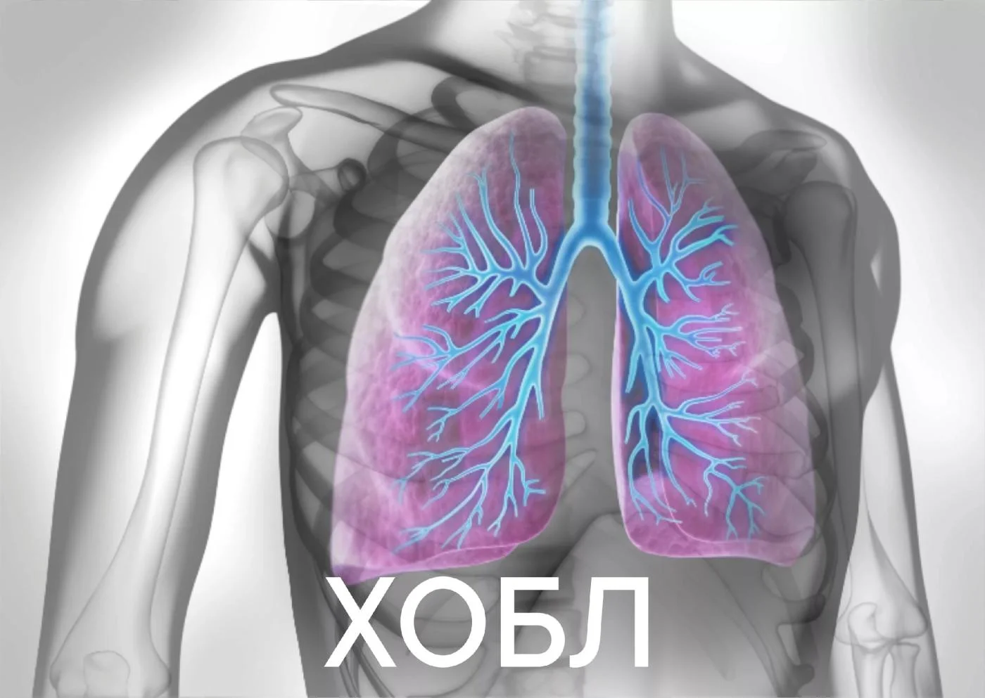 Хроническая обструктивная болезнь лёгких (ХОБЛ)