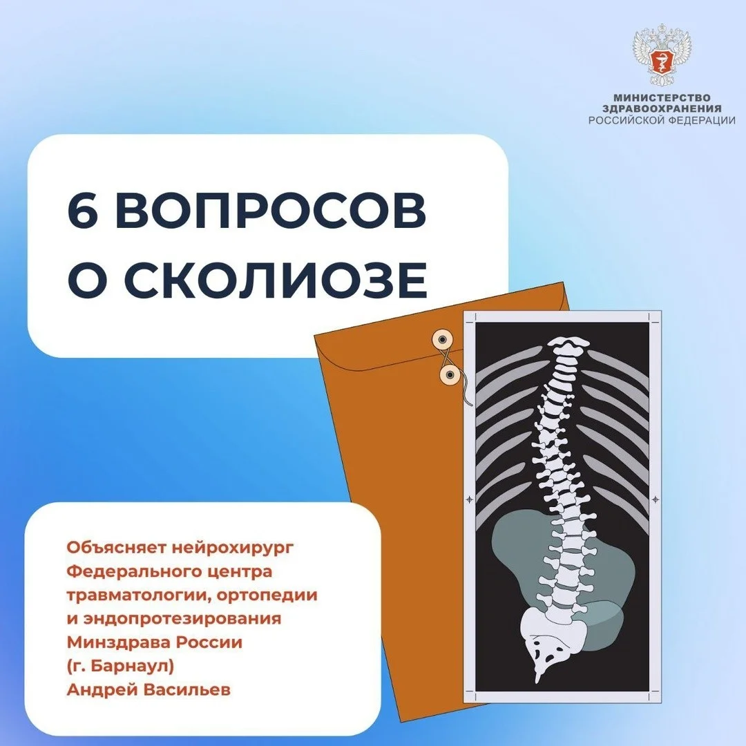 Сколиоз? Что вы знаете о сколиозе?