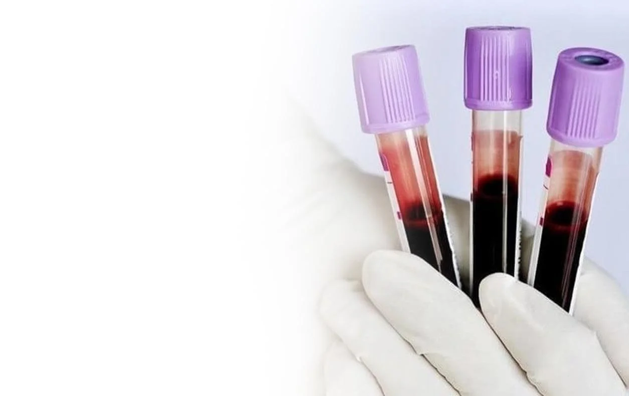 НЕОБХОДИМО СДАТЬ АНАЛИЗЫ?