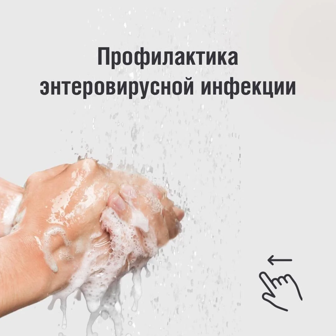 У ВИРУСА НЕ БЫВАЕТ ЛЕТНЕГО ОТПУСКА