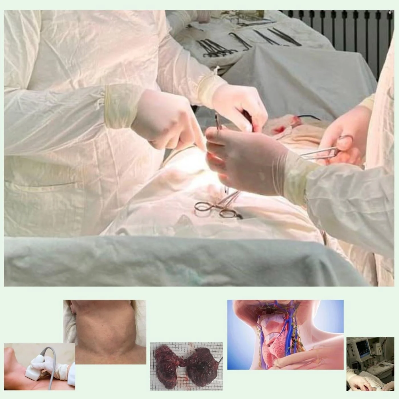 40 ЛЕТ ХОДИЛА С ГИГАНТСКИМ ЗОБОМ