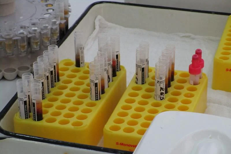 Вниманию пациенток, вставших на очередь на ЭКО!