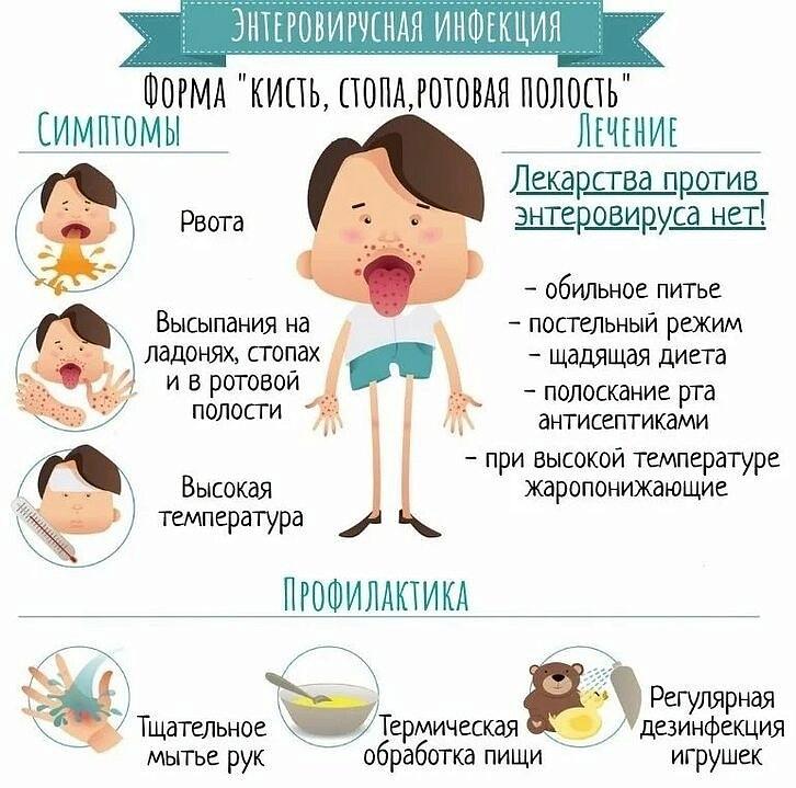 Энтеровирусная инфекция